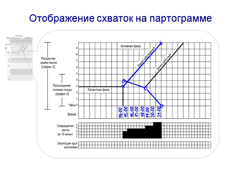 Отображение схваток на партограмме 14:00 15:00 16:00 17:00 18:00 19:00 20:00 21:00 O O